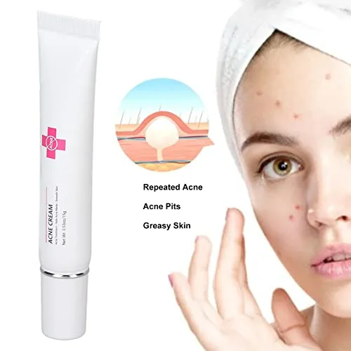 15g Acne Removal Cream, Moisturizing Acne Scars Treatment Cream Skin Repairing Cream, Fades Acne Spot, stubborn Scars, Pigmentation & Blemish