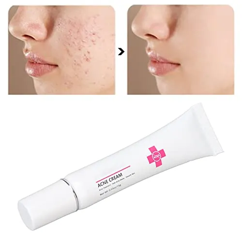 15g Acne Removal Cream, Moisturizing Acne Scars Treatment Cream Skin Repairing Cream, Fades Acne Spot, stubborn Scars, Pigmentation & Blemish
