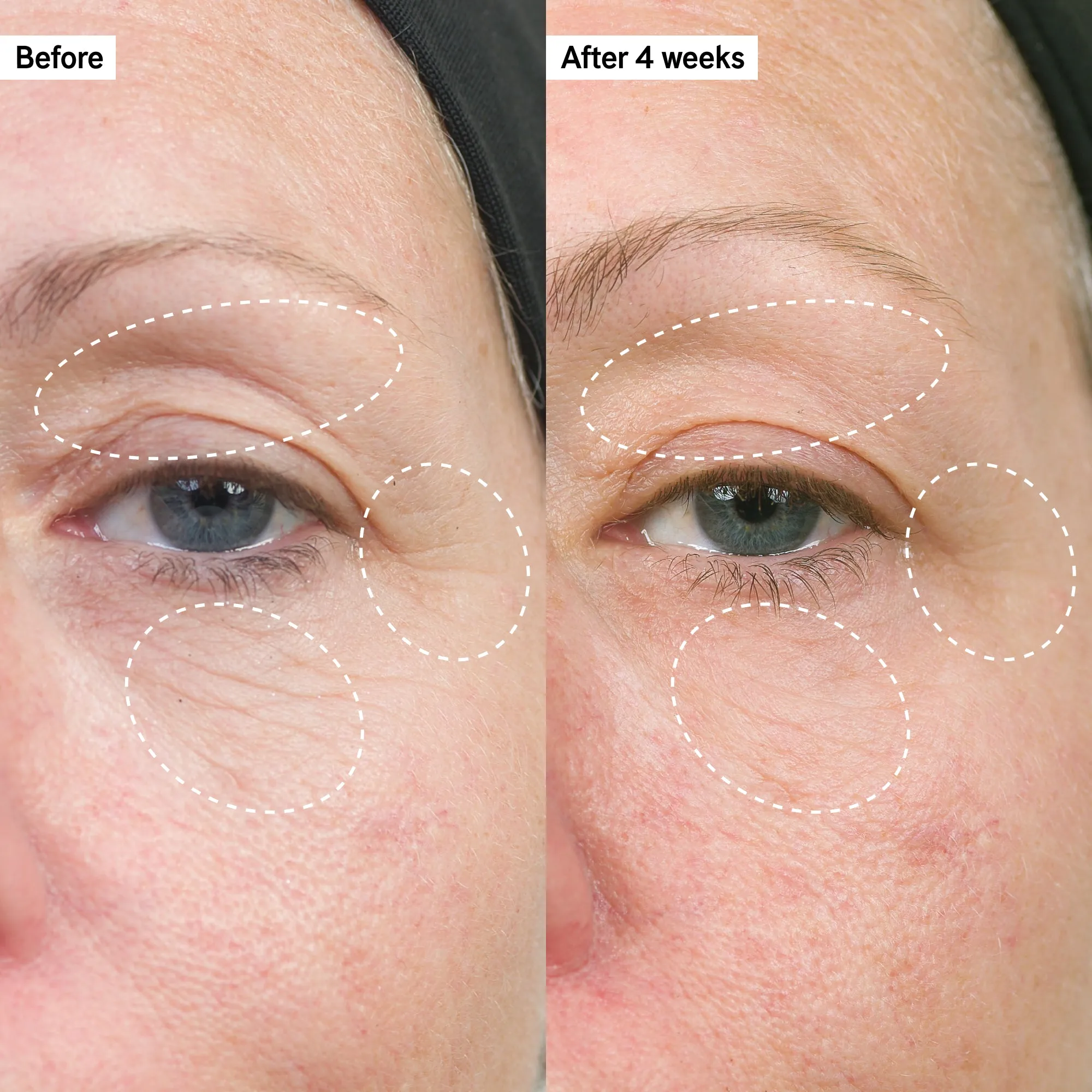 Intro Routine for Anti-Aging
