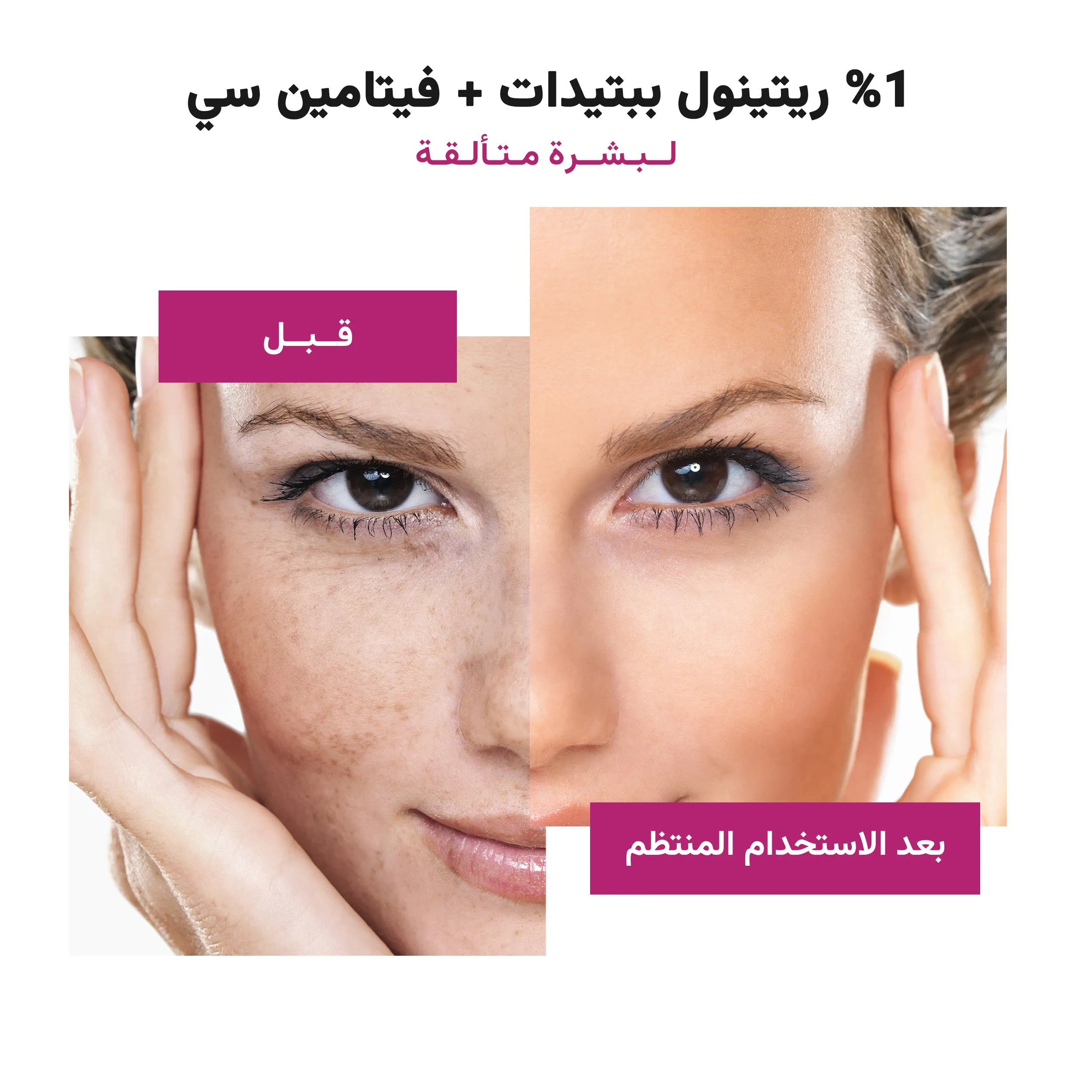 Repairing and Nourishing %1 Retinol Serum with Peptides   Vitamin C & Ceramide